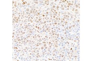 Immunohistochemistry (IHC) image for anti-Tumor Protein P53 Binding Protein 1 (TP53BP1) (AA 350-400) antibody (ABIN7453568) (TP53BP1 antibody  (AA 350-400))