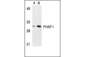 Western blot analysis of PHAP I expression in human Raji cell lysate with AP30663PU-N I at 2 μg/ml (lane A) and 4 μg/ml (lane B), respectively. (PHAP1 antibody  (C-Term))