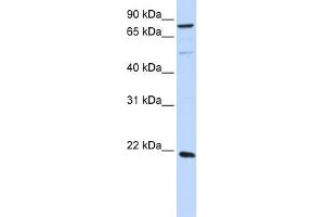 WB Suggested Anti-ARL11 Antibody Titration: 0. (ARL11 antibody  (Middle Region))