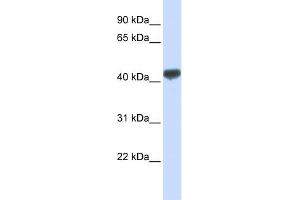WB Suggested Anti-ZRANB2 Antibody Titration:  0. (ZNF265 antibody  (N-Term))