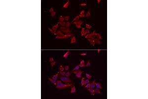 Immunofluorescence analysis of MCF-7 cells using RARRES2 antibody (ABIN5974187). (Chemerin antibody)