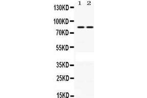 Observed bind size: 85KD (PLA2G4A antibody  (C-Term))