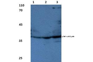 Western blot(WB) analysis of p-IkB-α antibody (NFKBIA antibody  (pTyr42))