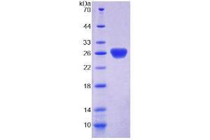 SDS-PAGE analysis of Mouse SSA1 Protein. (TRIM21 Protein)