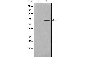 Western blot analysis on COLO205 cell lysate using TF2H2 Antibody,The lane on the left is treated with the antigen-specific peptide. (GTF2H2 antibody  (N-Term))