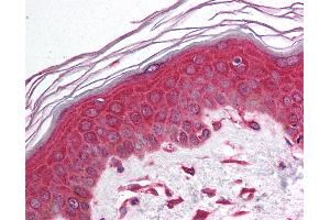 Immunohistochemistry (IHC) image for anti-Nuclear Factor of kappa Light Polypeptide Gene Enhancer in B-Cells Inhibitor, alpha (NFKBIA) (N-Term) antibody (ABIN6736740)