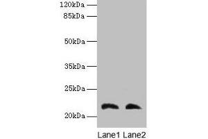 Western blot All lanes: LGALS9C antibody at 4 μg/mL Lane 1: Mouse stomach tissue Lane 2: Mouse liver tissue Secondary Goat polyclonal to rabbit IgG at 1/10000 dilution Predicted band size: 40 kDa Observed band size: 22 kDa (LGALS9C antibody  (AA 1-356))