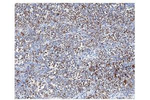 IHC analysis of ARF6 using anti-ARF6 antibody (ABIN4886473). (ARF6 antibody  (AA 2-175))