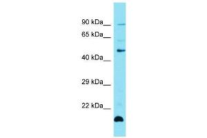 Host:  Rabbit  Target Name:  Zfp27  Sample Type:  Mouse Thymus lysates  Antibody Dilution:  1. (Zinc Finger Protein 27 (ZFP27) (Middle Region) antibody)