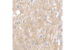 Immunohistochemistry of paraffin-embedded human liver using IQG Rabbit mAb (ABIN7268021) at dilution of 1:25 (40x lens). (IQGAP2 antibody)