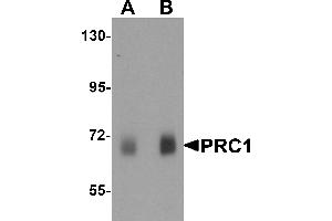 Western blot analysis of PRC1 in human skeletal muscle tissue lysate with Prc1 antibody at (A) 0. (PRC1 antibody  (Middle Region))