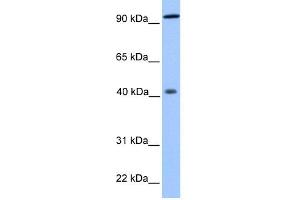 WB Suggested Anti-PYGO1 Antibody Titration:  0. (PYGO1 antibody  (N-Term))