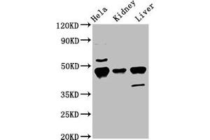 Western Blot Positive WB detected in: Hela whole cell lysate, Mouse kidney tissue, Mouse liver tissue All lanes: Krt18 antibody at 5. (Cytokeratin 18 antibody  (AA 200-423))