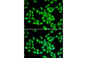 Immunofluorescence analysis of HeLa cells using PCMT1 antibody. (PCMT1 antibody)