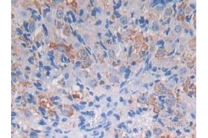 IHC-P analysis of Mouse Ovary Tissue, with DAB staining. (PROZ antibody  (AA 23-399))