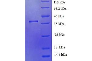 SDS-PAGE (SDS) image for Jumonji Domain Containing 7 (JMJD7) (AA 1-316), (full length) protein (His tag) (ABIN4974417)