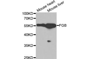 Western blot analysis of extracts of various cell lines, using FGB antibody. (Fibrinogen beta Chain antibody)