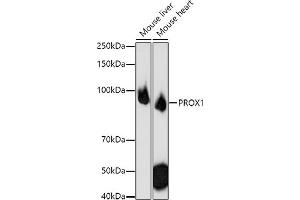 Western blot analysis of extracts of various cell lines, using PROX1 antibody (ABIN6132519, ABIN6146252, ABIN6146253 and ABIN6216882) at 1:1000 dilution. (PROX1 antibody  (AA 1-300))