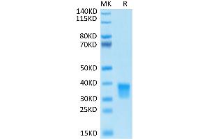 Oncostatin M Protein (OSM) (His-Avi Tag,Biotin)
