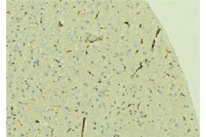 ABIN6279652 at 1/100 staining Mouse brain tissue by IHC-P. (PREX1 antibody  (Internal Region))