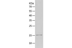 Western Blotting (WB) image for Ubiquitin Specific Peptidase 5 (USP5) (AA 163-291) protein (His tag) (ABIN7286186) (USP5 Protein (AA 163-291) (His tag))