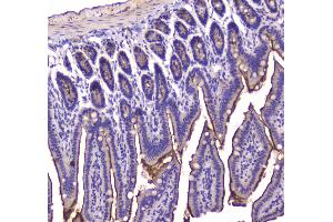 IHC analysis of Cannabinoid Receptor I using anti-Cannabinoid Receptor I antibody . (CNR1 antibody  (AA 1-75))
