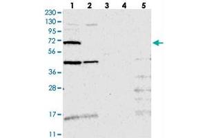 Western blot analysis of Lane 1: RT-4, Lane 2: U-251 MG, Lane 3: Human Plasma, Lane 4: Liver, Lane 5: Tonsil with TMEM87B polyclonal antibody  at 1:250-1:500 dilution.