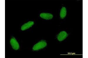 Immunofluorescence of purified MaxPab antibody to RAD51L1 on HepG2 cell. (RAD51 Homolog B antibody  (AA 1-384))