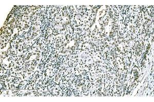IHC analysis of ADAR1/ADAR using anti-ADAR1/ADAR antibody (ABIN7598956).