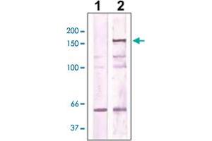 The cell lysate derived from NIH/3T3 was immunoprecipitated by ROCK2 polyclonal antibody , then immunoprobed by the same antibody at 1 : 500 (lane 2). (ROCK2 antibody  (AA 250-350))