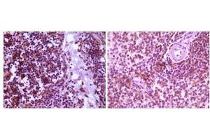 Immunohistochemical analysis of paraffin-embedded human thymoma tissue (left) and spleen tissue (right), showing cytoplasmic localization using MAP2K4 antibody with DAB staining. (MAP2K4 antibody)