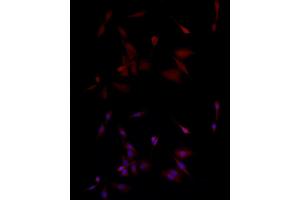 Immunofluorescence analysis of PC-12 cells using PGP9. (UCHL1 antibody  (AA 1-220))