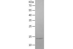 Western Blotting (WB) image for ATPase, H+ Transporting, Lysosomal 13kDa, V1 Subunit G3 (ATP6V1G3) (AA 1-118) protein (His tag) (ABIN7283463) (ATP6V1G3i Protein (AA 1-118) (His tag))