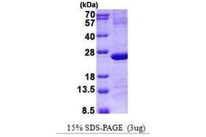 Figure annotation denotes ug of protein loaded and % gel used. (IMP3 Protein)