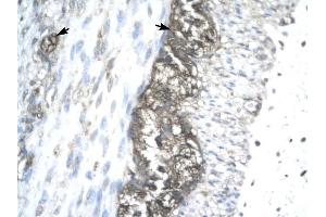 ACAT2 antibody was used for immunohistochemistry at a concentration of 4-8 ug/ml to stain Ganglionic cells (arrows) in Human Stomach.