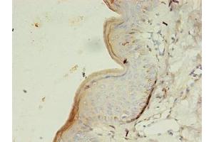 Immunohistochemistry of paraffin-embedded human skin tissue using ABIN7154151 at dilution of 1:100 (GK3P antibody  (AA 1-220))