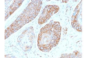 Formalin-fixed, paraffin-embedded human Pancreas stained with Spectrin Beta 3 Rabbit Monoclonal Antibody (SPTBN2/2979R). (Recombinant Spectrin, Beta, Non-erythrocytic 2 (SPTBN2) (AA 356-475) antibody)