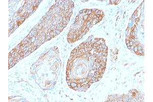 Immunohistochemistry (IHC) image for anti-Spectrin, Beta, Non-erythrocytic 2 (SPTBN2) (AA 356-475) antibody (ABIN6940657)