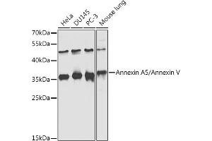 Western blot analysis of extracts of various cell lines, using Annexin /Annexin V antibody  at 1:1000 dilution. (Annexin V antibody  (AA 1-320))