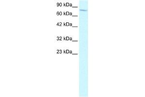 WB Suggested Anti-ENG Antibody Titration:  2. (Endoglin antibody  (N-Term))