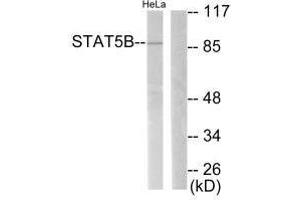 Western blot analysis of extracts from RAW264. (STAT5B antibody  (Ser731))