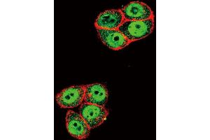 Confocal immunofluorescent analysis of Phospho-SD2- Antibody (ABIN650816 and ABIN2839794) with Hela cell followed by Alexa Fluor 488-conjugated goat anti-rabbit lgG (green). (SMAD2 antibody  (pThr220))