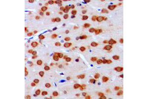 Immunohistochemical analysis of TCFL4 staining in human brain formalin fixed paraffin embedded tissue section. (MLX antibody  (Center))