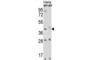 Western Blotting (WB) image for anti-Hyaluronidase-2 (HYAL2) antibody (ABIN2996780) (HYAL2 antibody)