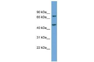 AGGF1 antibody used at 1 ug/ml to detect target protein. (AGGF1 antibody  (Middle Region))