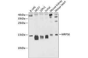 Western blot analysis of extracts of various cell lines, using MRPS6 antibody (ABIN6133092, ABIN6144048, ABIN6144049 and ABIN6225227) at 1:1000 dilution. (MRPS6 antibody  (AA 1-125))