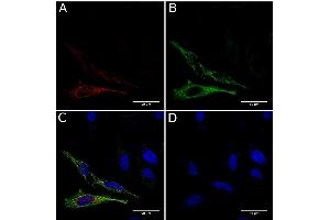 Immunofluorescence staining of fixed HeLa cells expressing mCherry tagged GCN4 with anti-GCN4 antibody C11L34. (Recombinant GCN4 antibody)