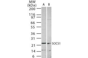 Image no. 1 for anti-Suppressor of Cytokine Signaling 1 (SOCS1) (AA 54-68) antibody (ABIN233230) (SOCS1 antibody  (AA 54-68))