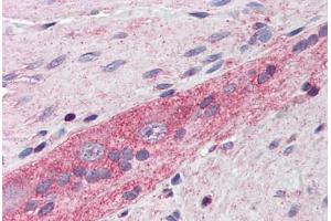 Human Small Intestine, Myenteric Plexus: Formalin-Fixed, Paraffin-Embedded (FFPE) (RHOA antibody  (AA 1-194))