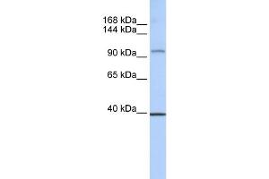 WB Suggested Anti-REST Antibody Titration:  0. (REST antibody  (Middle Region))